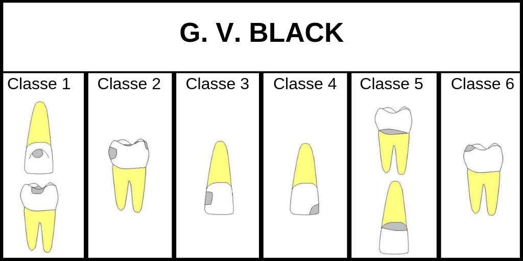 G.V. Black